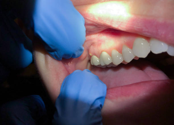 Dentist for Dental Trauma in HI